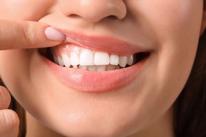 Junge Frau zeigt Ihr gesundes Zahnfleisch